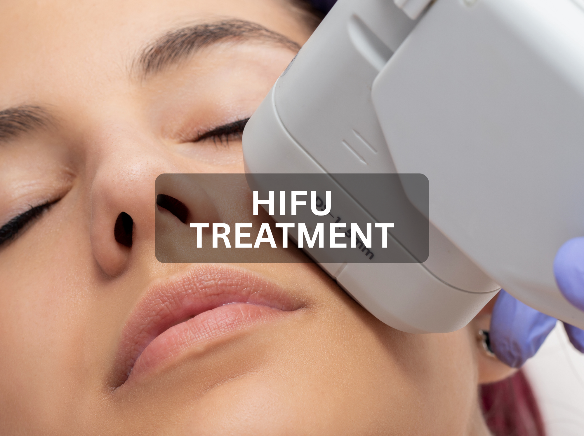 Hifu Treatment